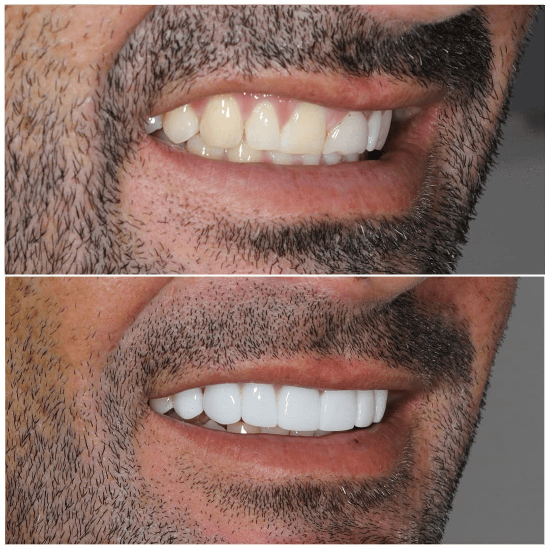 Before & After Images