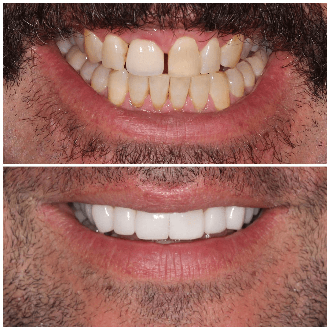 Before & After Images