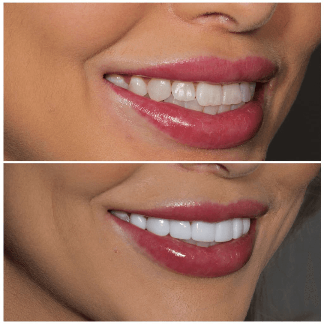 Before & After Images