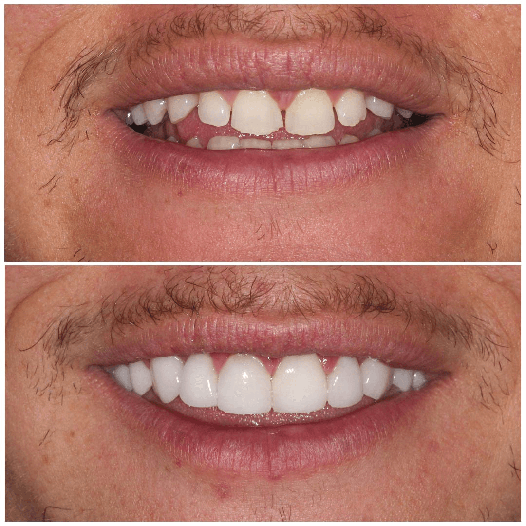 Before & After Images