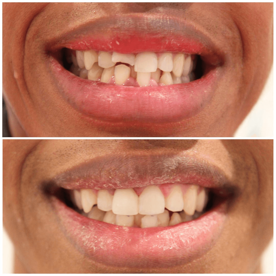 Before & After Images