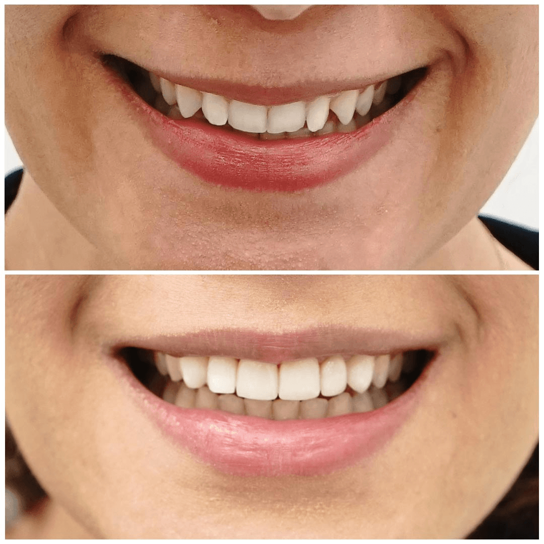 Before & After Images