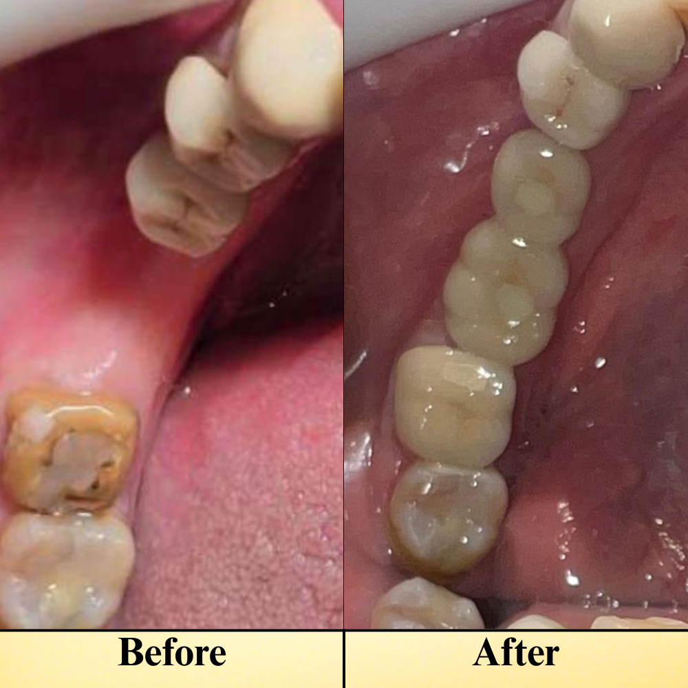 Before & After Images
